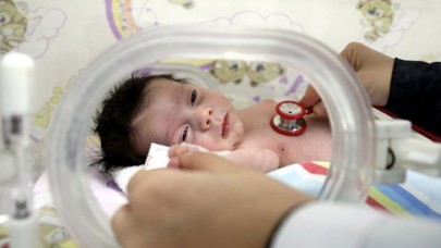 Kalbi sağda, karaciğeri solda... Tüm organları ters doğdu