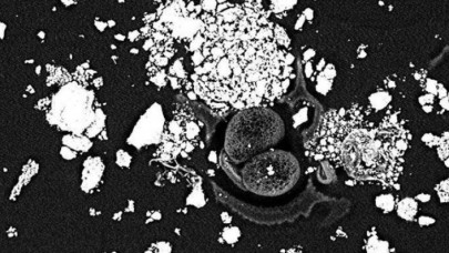 İstanbulda yaşayanlar dikkat! Araştırmadan akciğer kanseri çıktı