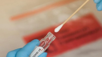 PCR testleri negatife döndü! Koronavirüs tedavisinde mucize meyve