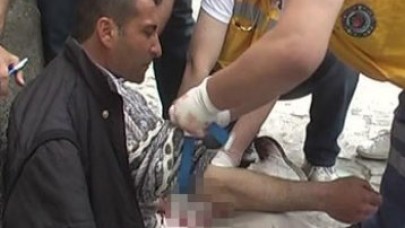 Bir anda kesmeye başladı!