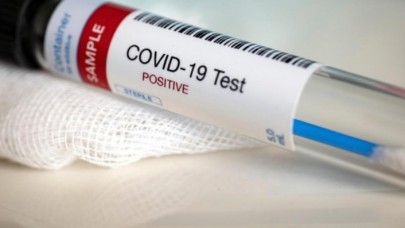 Semptom gösterdiği halde testi negatif çıkanlara çarpıcı uyarı!