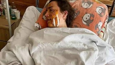 1inci Dünya Savaşından kalma bomba patladı, balayı kabusa döndü!