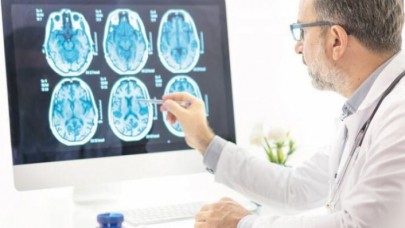 Obezitedeki artışın sonucu: İnsanların beyni küçüldü