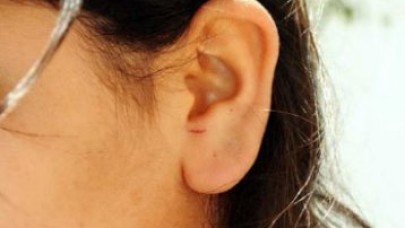 Kulak çekti görevden alındı