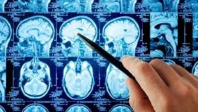 Beyin kanamasını 1 dakikada tespit eden teknoloji Cerrahpaşada