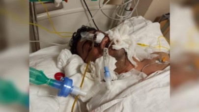 Silivride işkence iddiası; Savcılık bu görüntüye tıbbi müdahale sonucu dedi