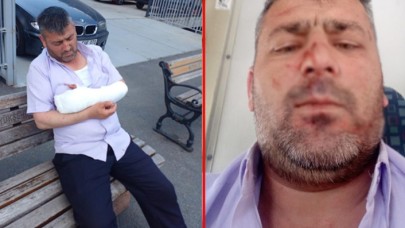 İETT şoförünün çilesi bitmiyor! 2 ay önce taşlamışlardı şimdi de bıçakladılar