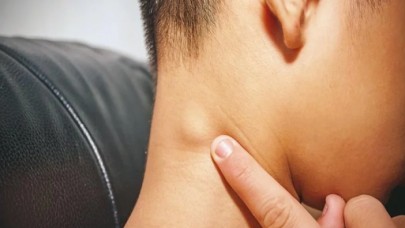 Maymun çiçeği bir ülkeye daha sıçradı