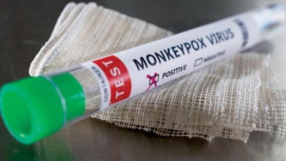 Maymun çiçeği ile ilgili korkutan gelişme: 104 vaka tespit edildi!