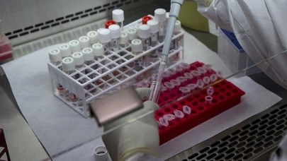 DSÖden maymun çiçeği virüsü açıklaması: Merkez üssü Avrupa