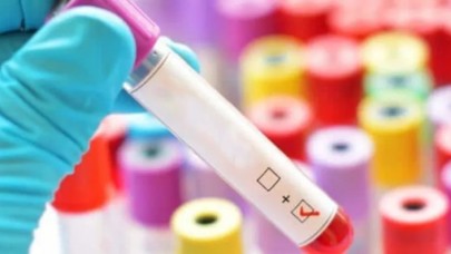 1998den önce doğanlar dikkat: Test yaptırın!