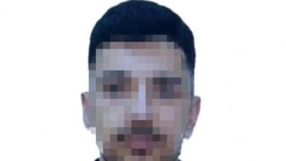 21 yaşındaki genç kadın eski sevgilisi tarafından kezzapla yaralandı