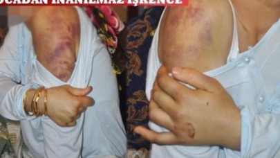 Vücudu böyle, yüzünü hiç sormayın