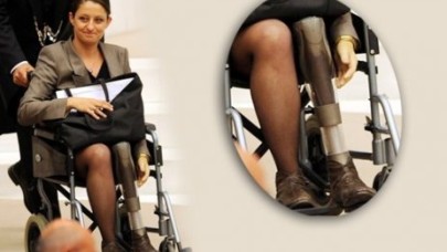 PAVEY: BACAĞIMI GÖSTERMEME DERDİM YOK