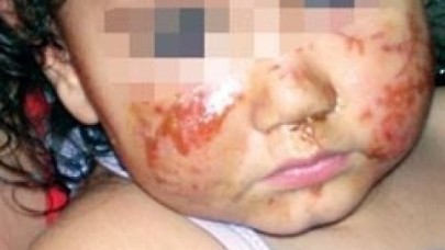 Kreşte ‘küçük’ bir sorun var