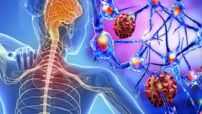 MS Hastalarına Umut