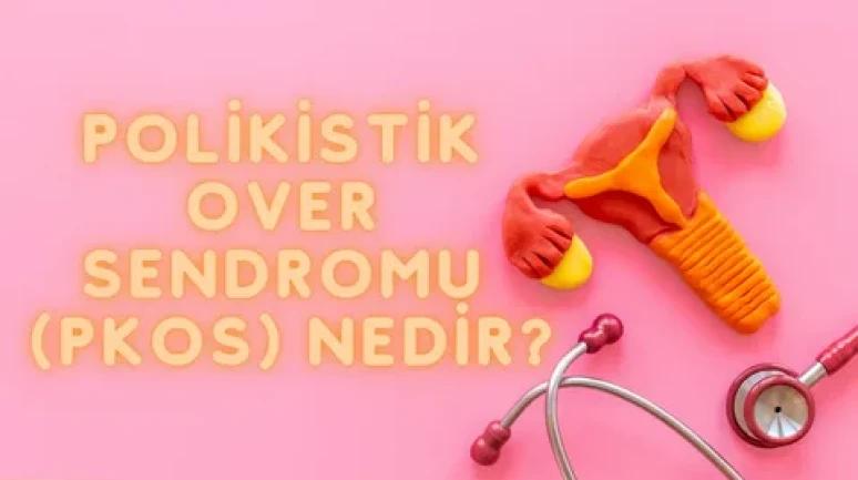 Kadınlarda polikistik over sendromu’na dikkat!